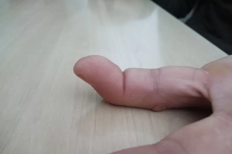 Tko se potpiše, olako ne piše – osvrt na reakciju Doma zdravlja Tomislavgrad