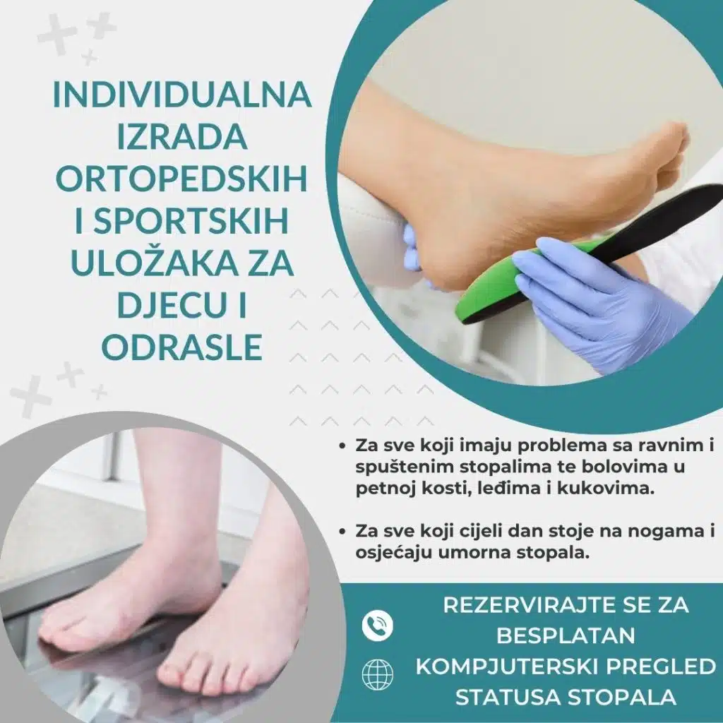 Korak prema zdravlju: Besplatno skeniranje stopala u Biopharm ljekarni u Neumu